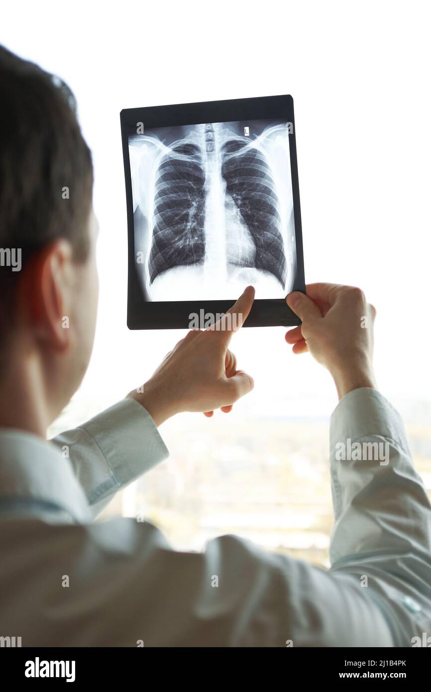 Man in shirt holds fluorography in light. Doctor shows the problem. Stock Photo