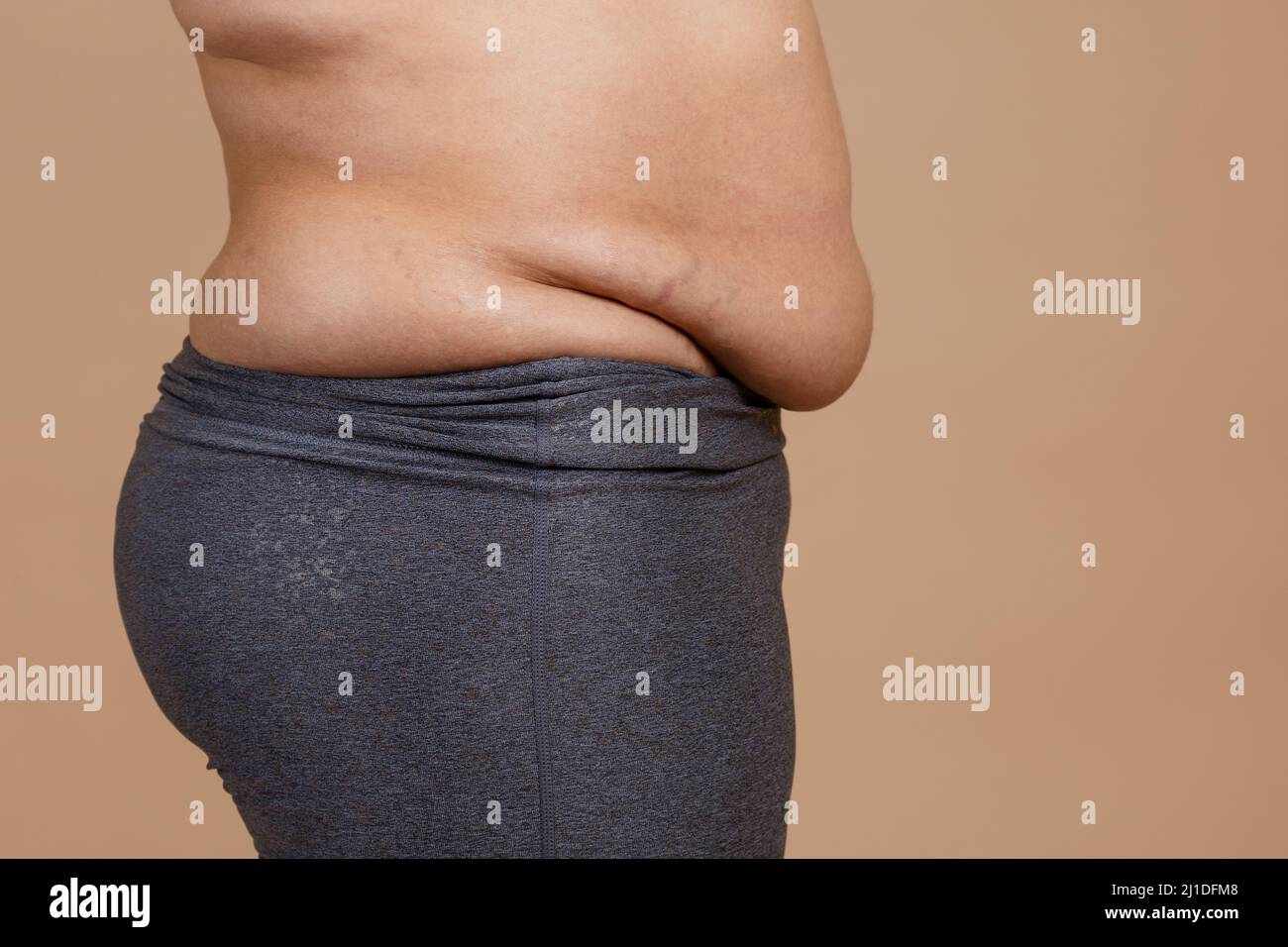 Untoned Stomach