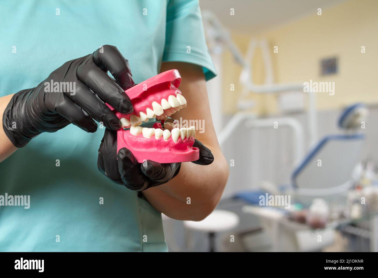 Dentist holding layout of the human jaw Stock Photo - Alamy