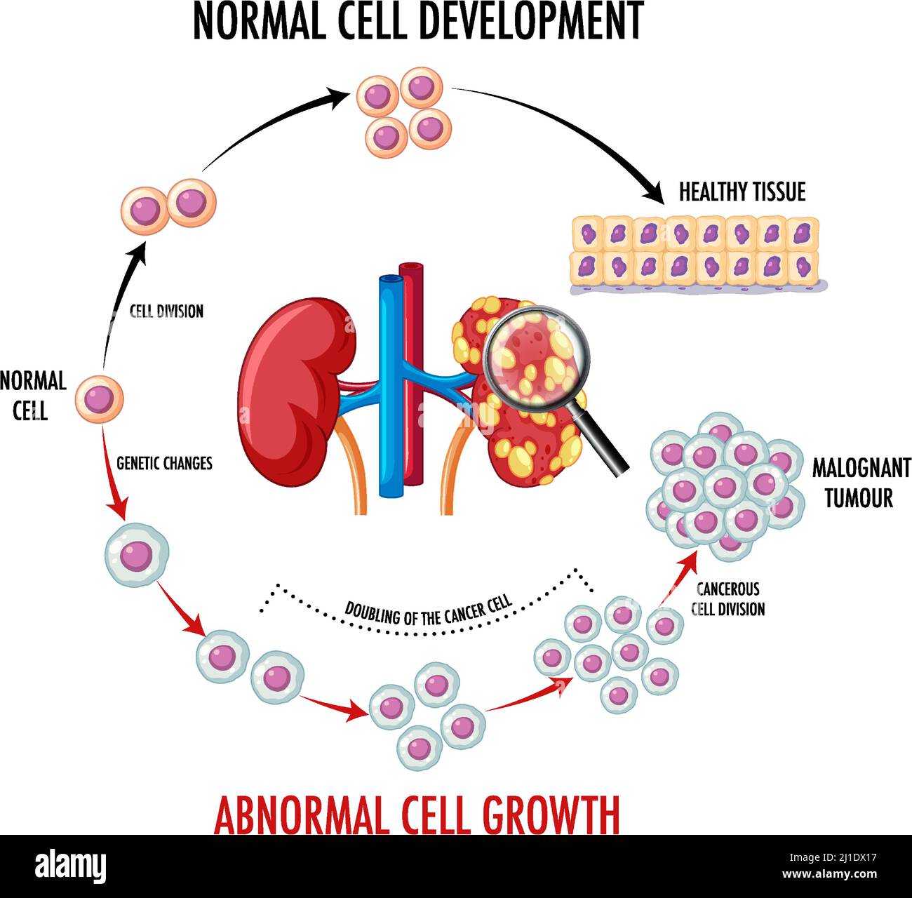 Diagram showing normal and cancer cell illustration Stock Vector Image ...