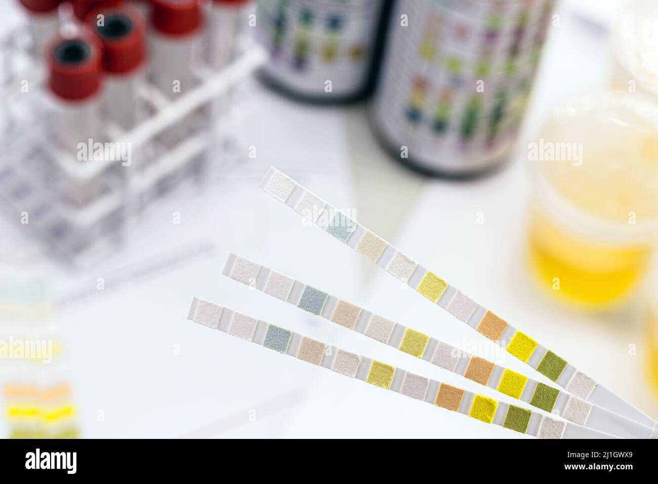 reagent strips used in urinalysis to analyze Leukocytes, Urobilinogen