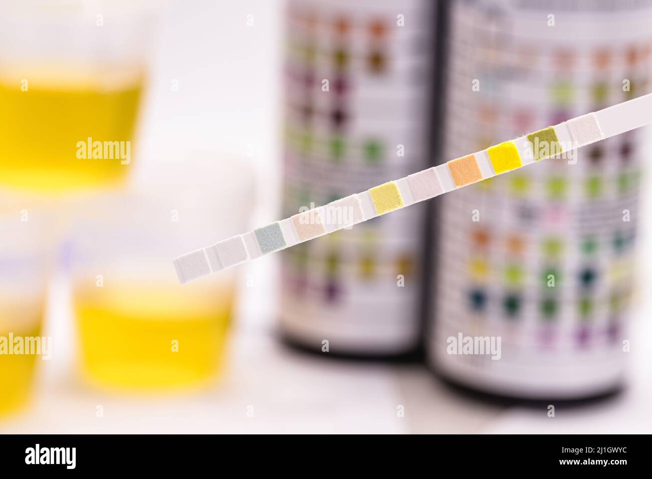 reagent strips used in urinalysis to analyze Leukocytes, Urobilinogen