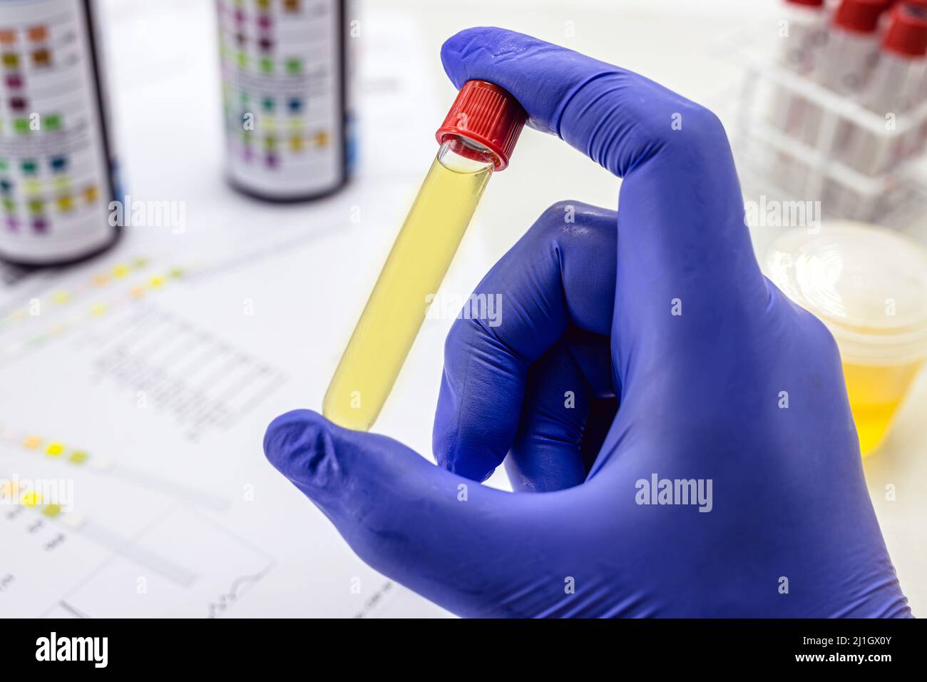 urine bottle held by healthcare professionals with latex glove