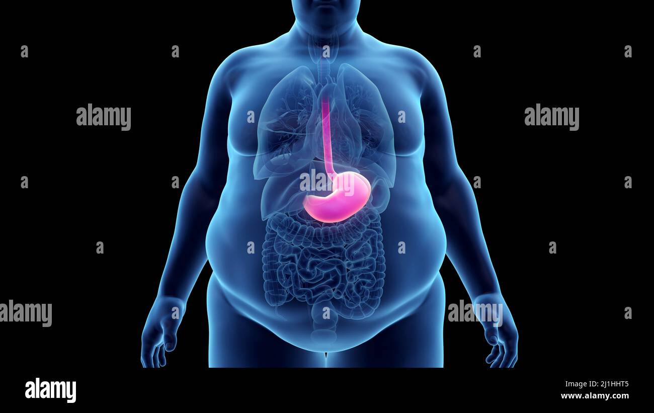Obese man's stomach, illustration Stock Photo - Alamy
