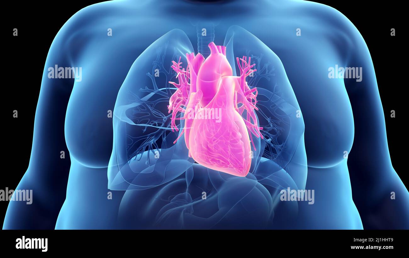 Obese man's heart, illustration Stock Photo - Alamy