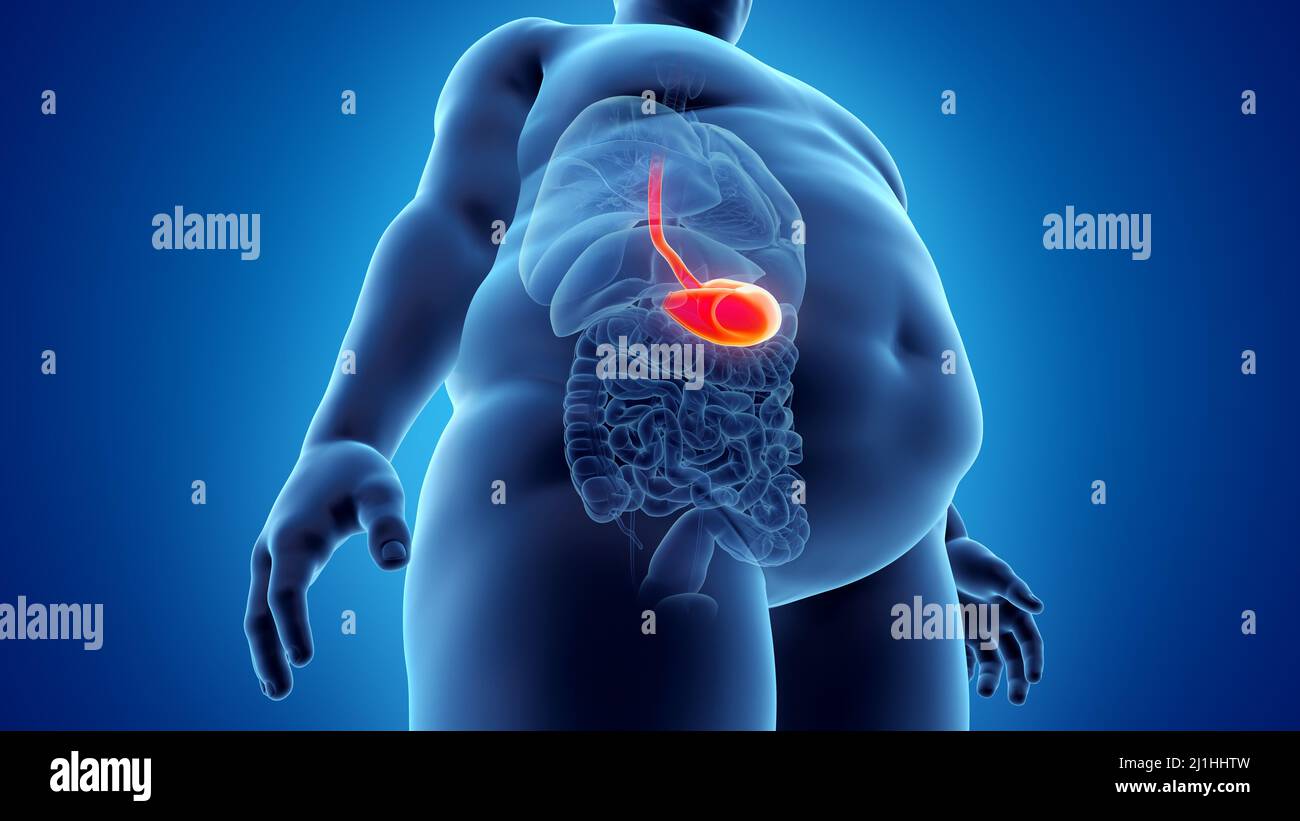 Obese man's stomach, illustration Stock Photo - Alamy