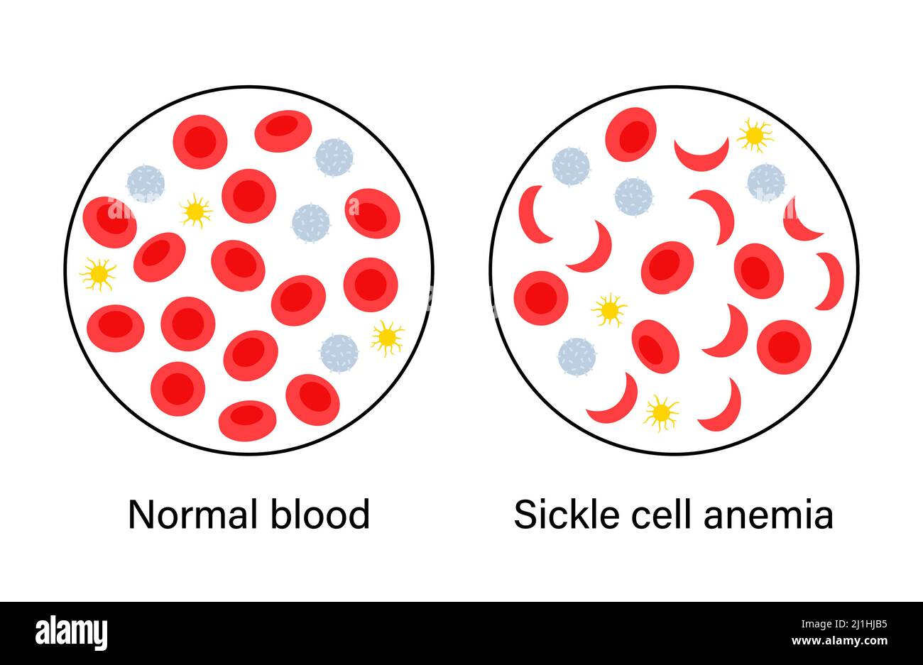 Normal red blood cell sickle hi-res stock photography and images - Alamy