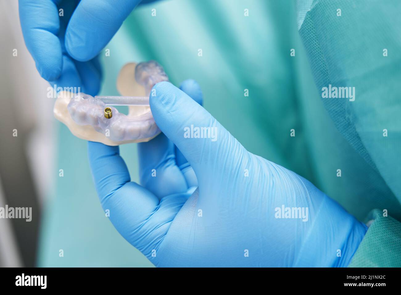 Doctor hands holding teeth model with dental implant Stock Photo - Alamy