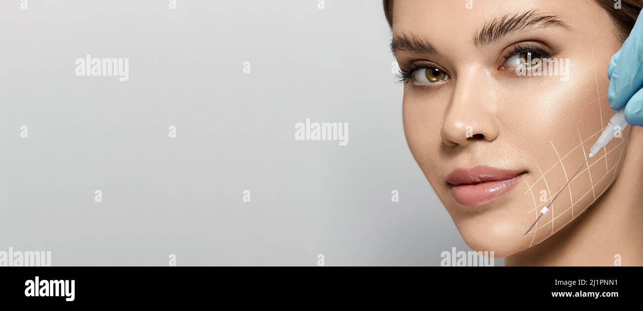 Aptos thread lifting for female face. Woman's face, advertisement ...