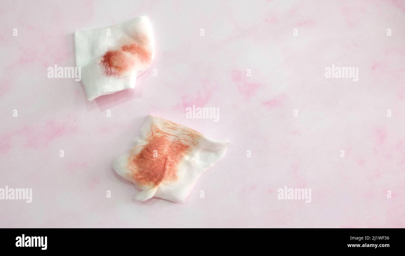 Two pieces of cotton pads with red stain from wiping off lipstick. With copy space on the right. Stock Photo