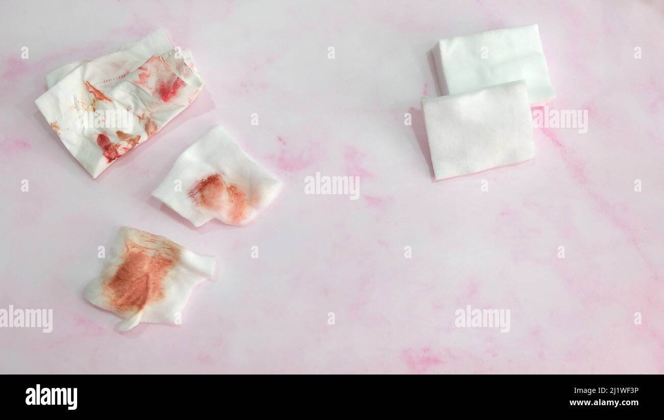 Pieces of cotton pads and tissue paper with red stain from wiping off make-up. With clean cotton pad on the right. Stock Photo