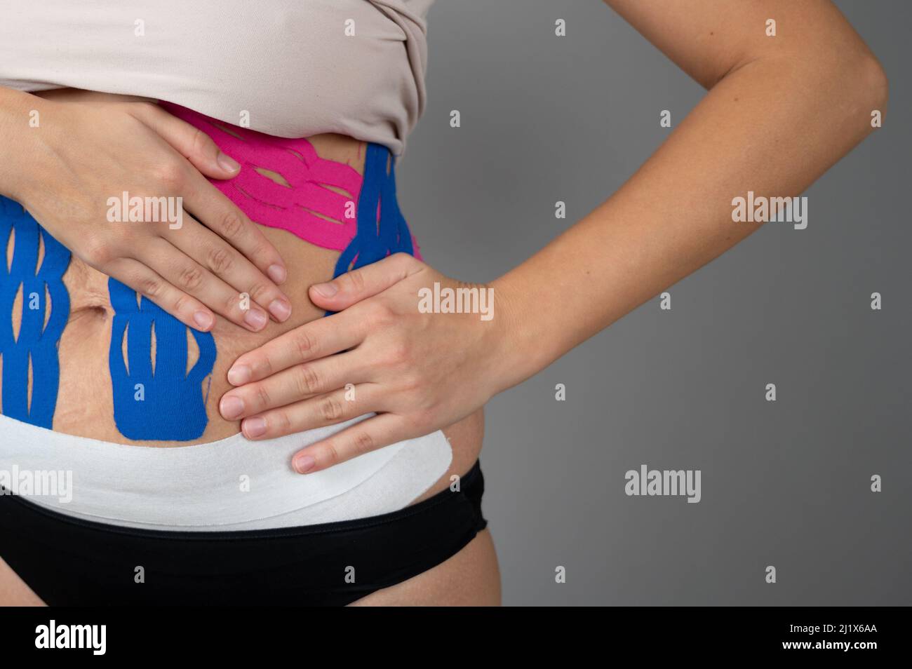 Therapeutic kinesiotape on the body. Close up view of kinesiology tape