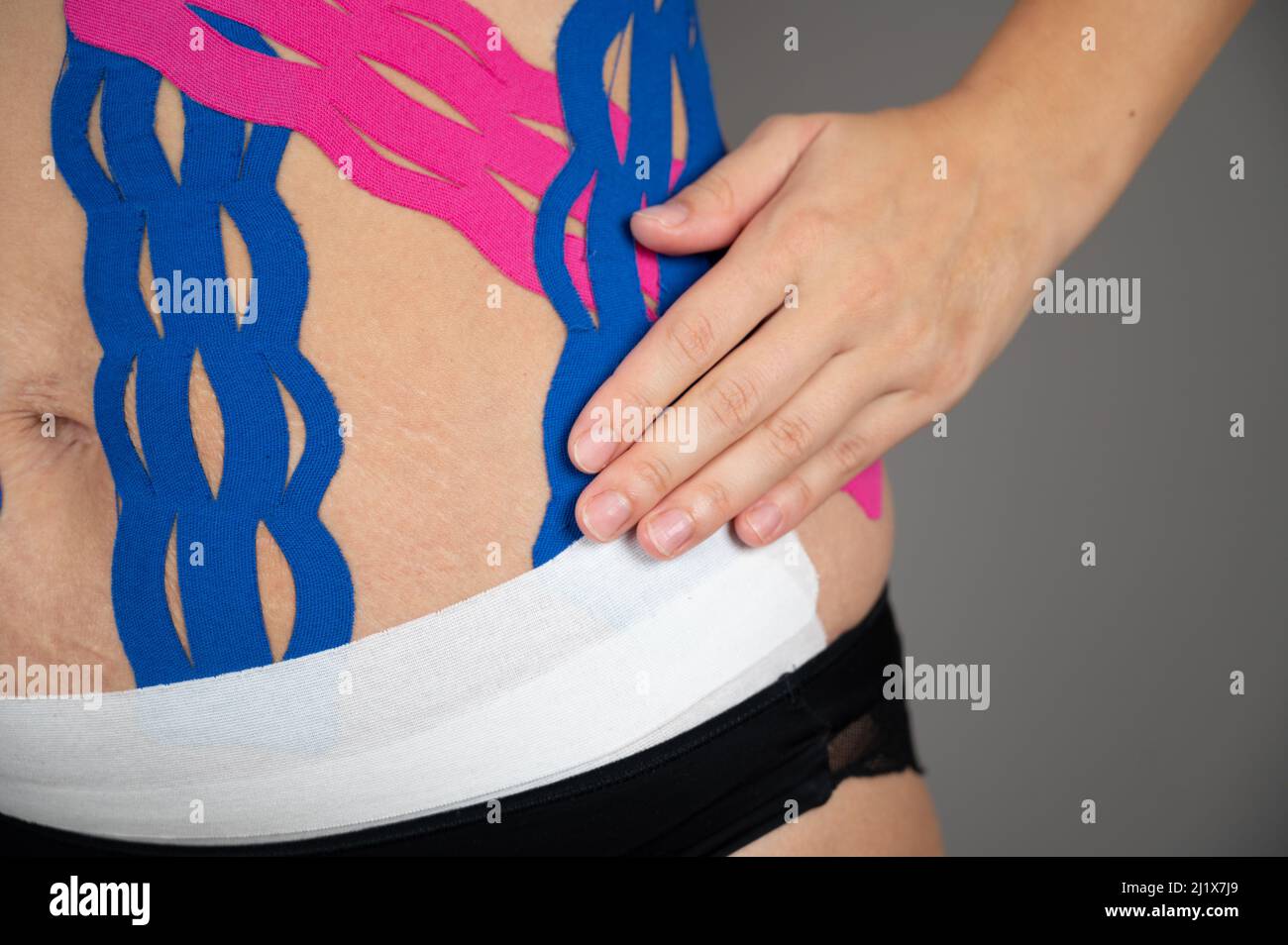 Closeup of female body with kinesio tape on the abdomen. Fat lose