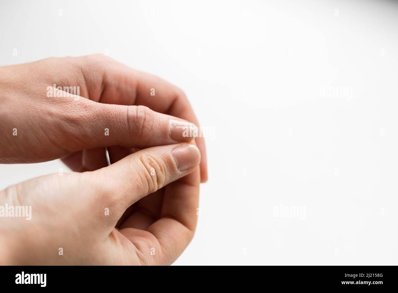 Close up of brittle nails on woman hand. White background. Brocken and dry fingernail. Avitaminosis and micro elements deficits  Stock Photo