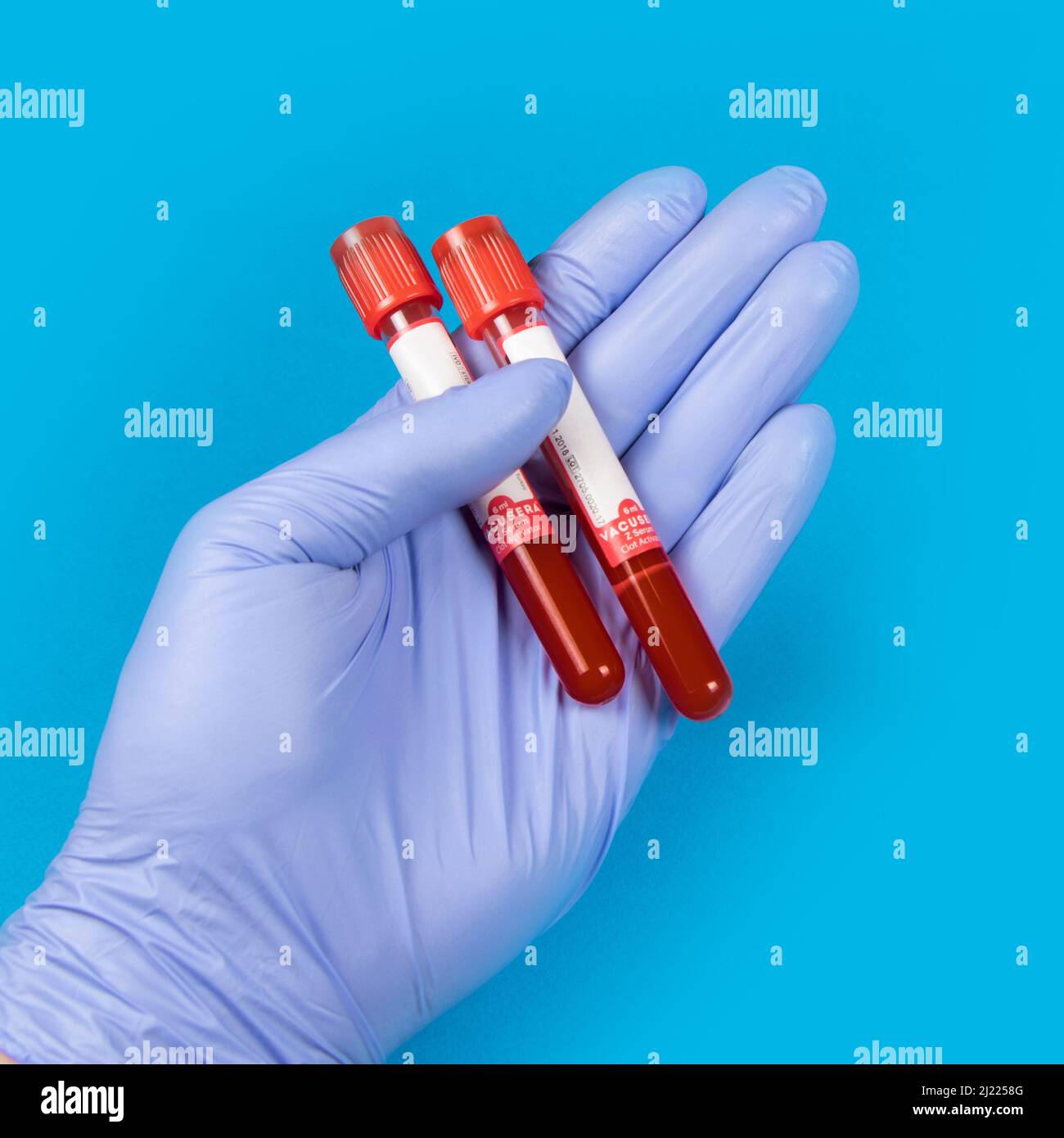 Hand of a doctor holding a bottle of blood sample. Blue background