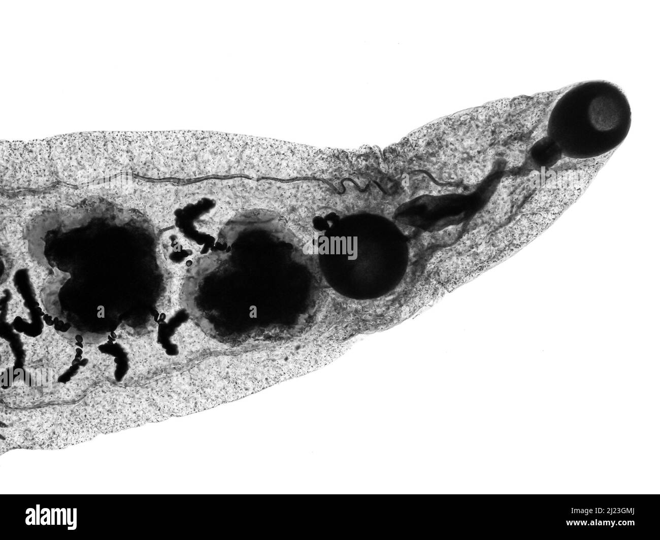 Parasitic worm. Mature Lancet liver fluke (Dicrocoelium dendriticum) under microscope. Oral sucker, ventral sucker. Stock Photo