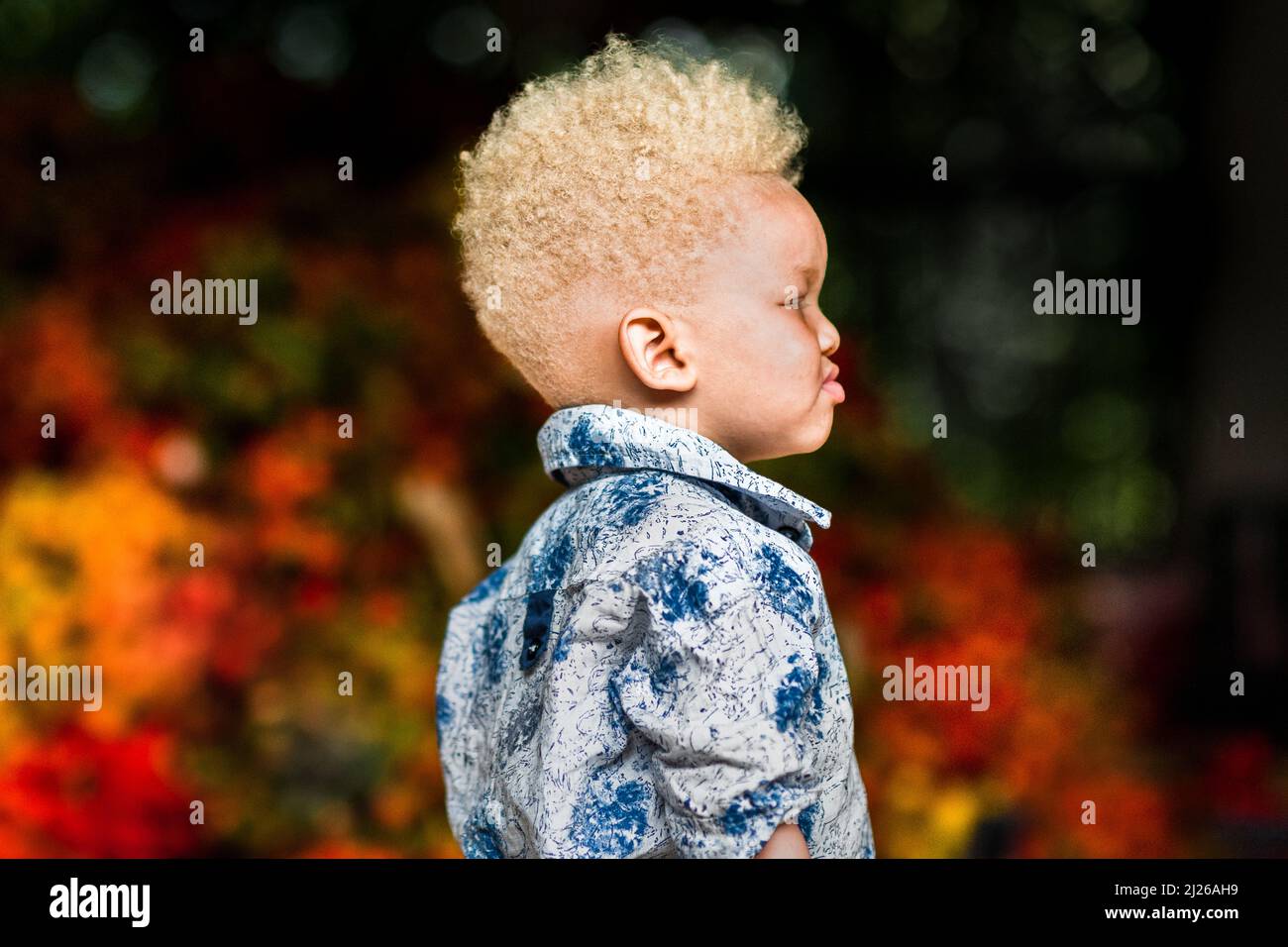 An Afro-Colombian albino boy hangs out during the chontaduro (peach palm) fruit processing in a facility in Cali, Valle del Cauca, Colombia. Stock Photo