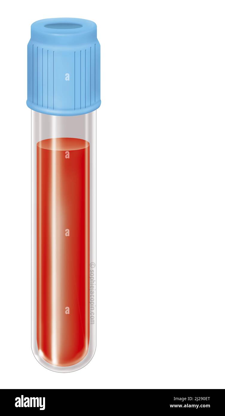 Test tube + blood Stock Photo