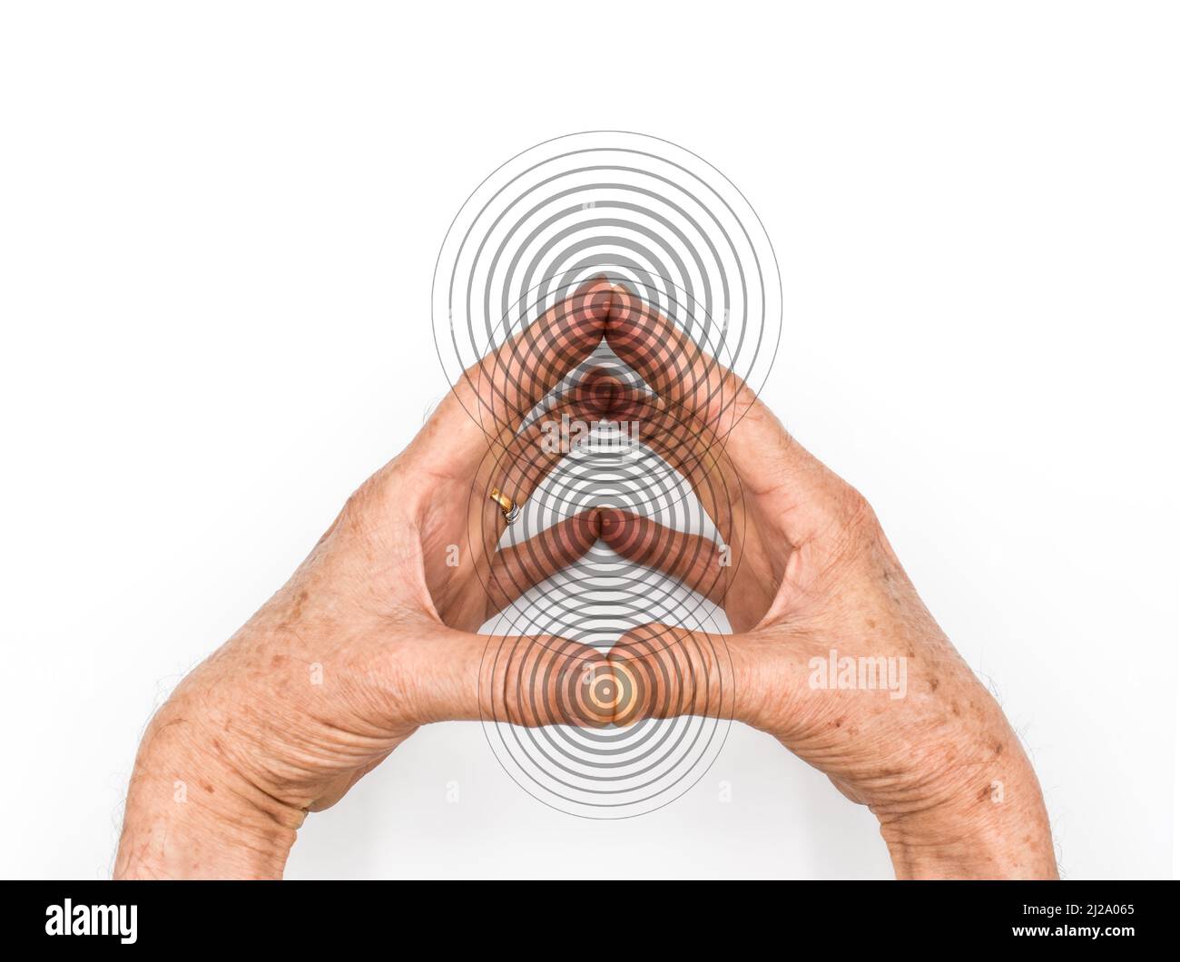Tingling and numbness in fingertips of Asian old man with diabetes