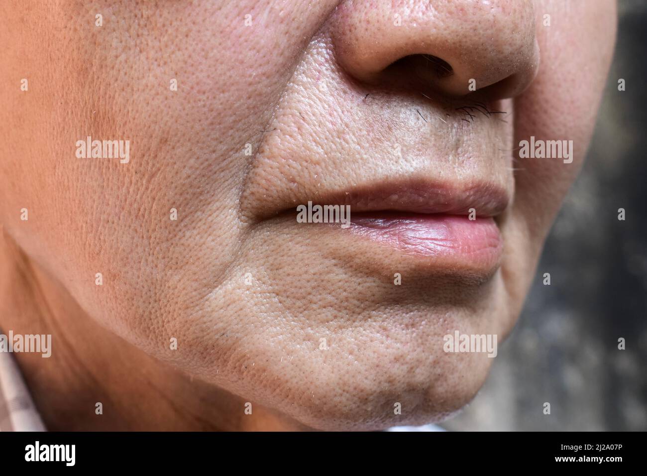 Enlarged pores in face of Southeast Asian, Chinese elder man with skin folds. Stock Photo