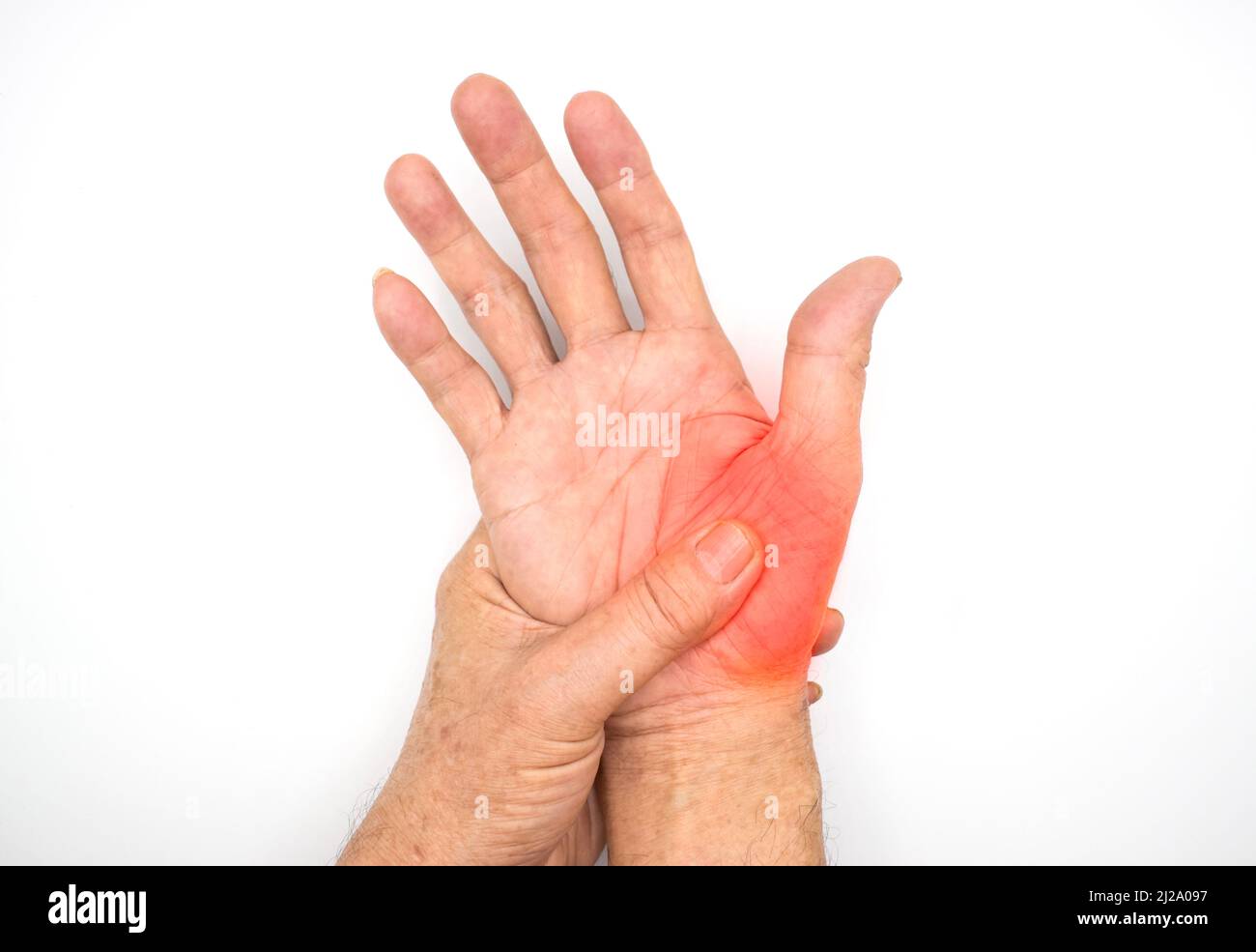 Painful thenar muscle of Asian old man. Concept of compartment syndrome, cellulitis and hand muscles pain. Stock Photo