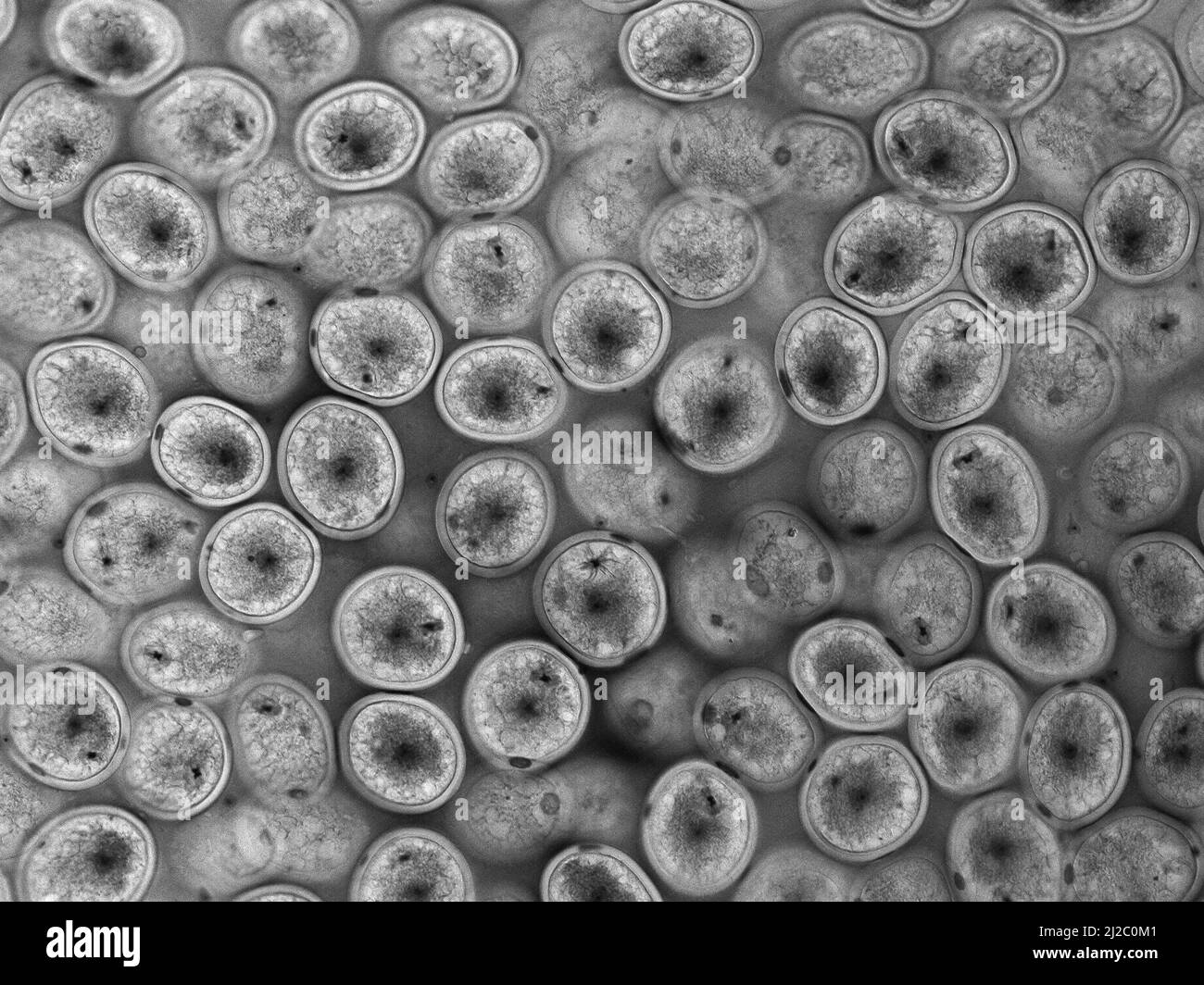 Ascaris (Ascaris   megalocephala) embryos in the uterus.   Fertilization in Ascaris (Ascaris megalocephala). Stock Photo