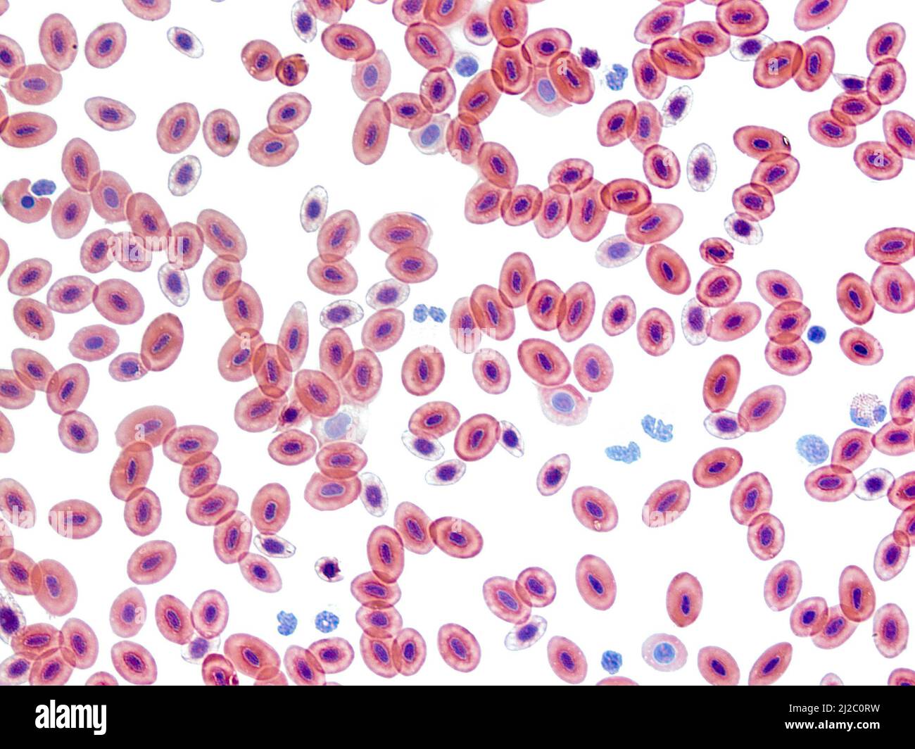 Frog blood, light microscopy. Unlike mammalian erythrocytes (red blood cells) mature frog erythrocytes retain their nuclei. Magnification: x400. Stock Photo