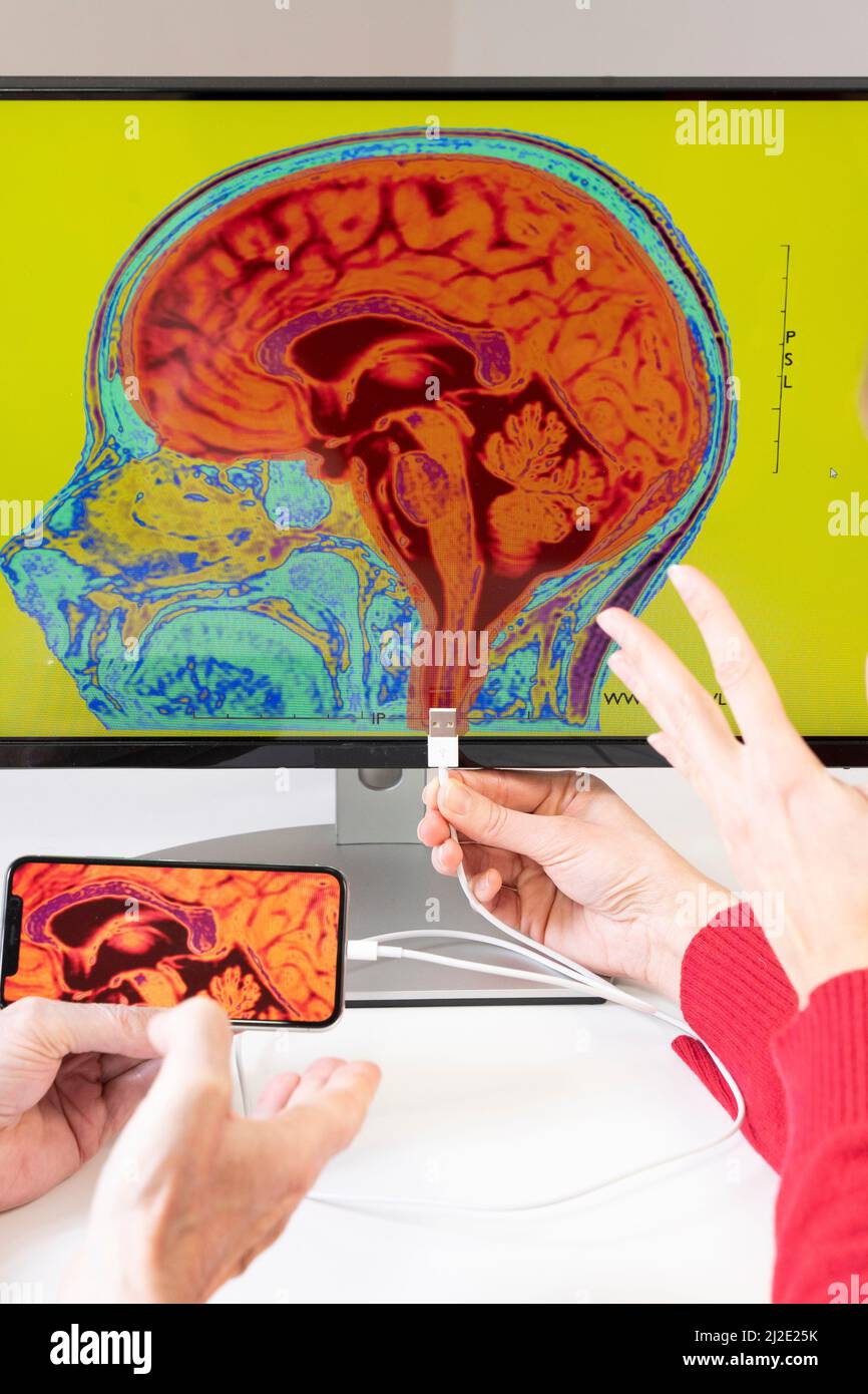 Smartphone connected to the brain Stock Photo - Alamy