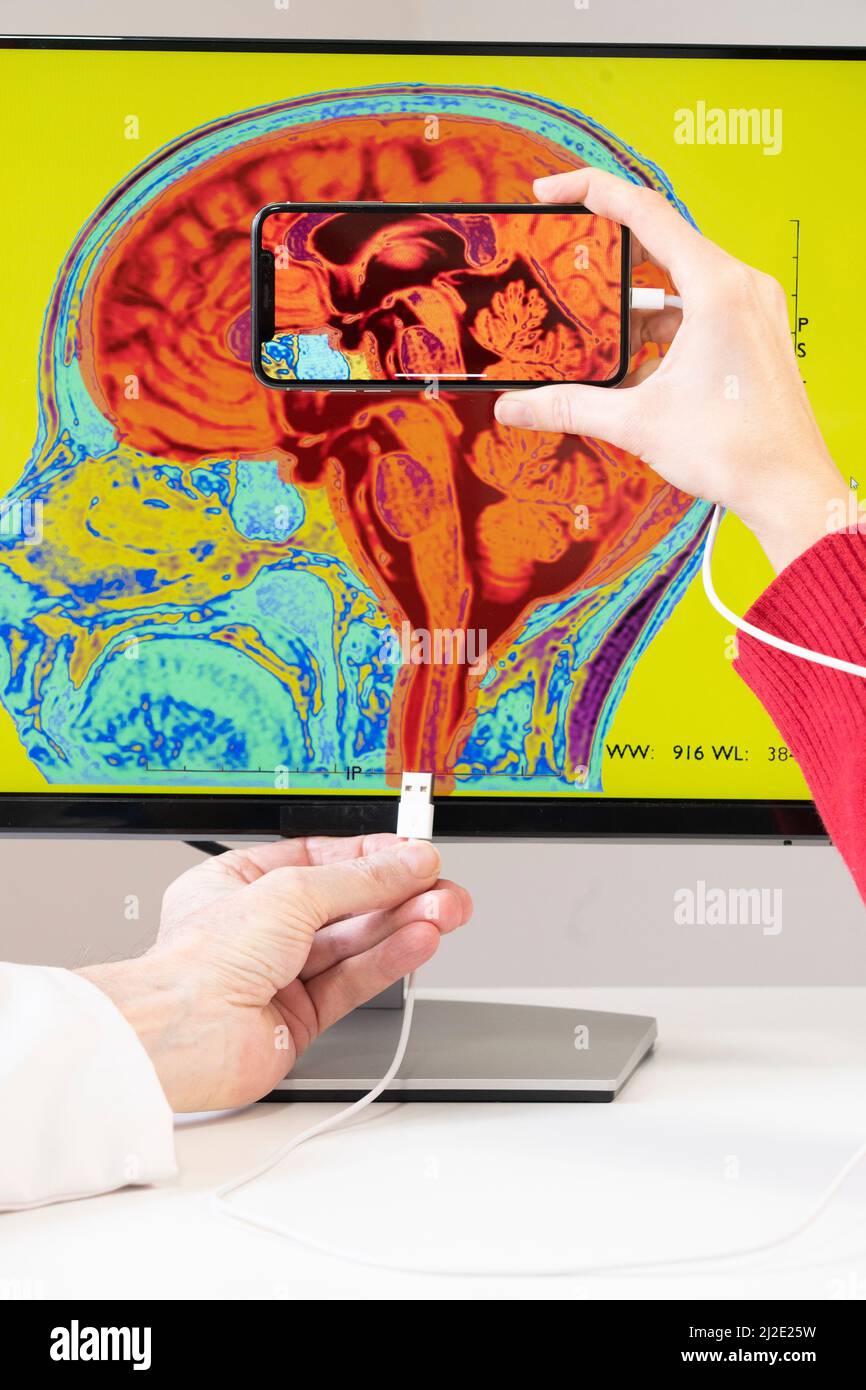 Smartphone connected to the brain Stock Photo - Alamy