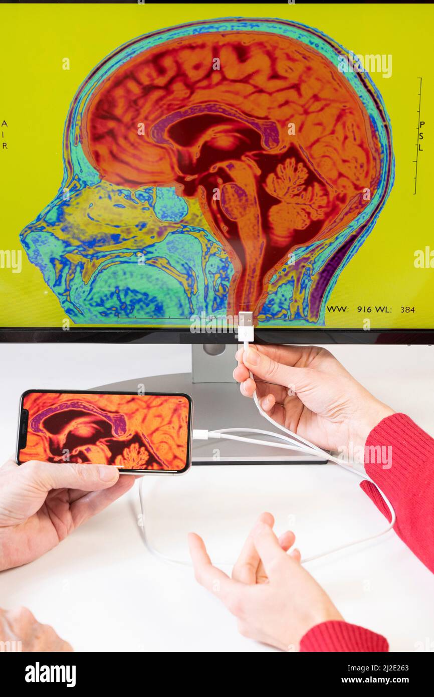 Smartphone connected to the brain Stock Photo
