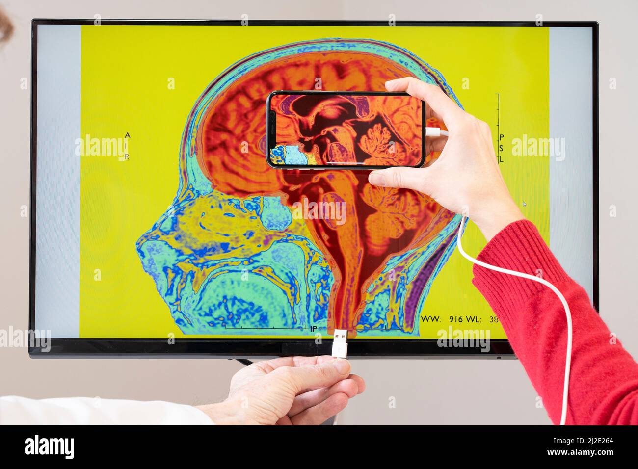 Smartphone connected to the brain Stock Photo - Alamy