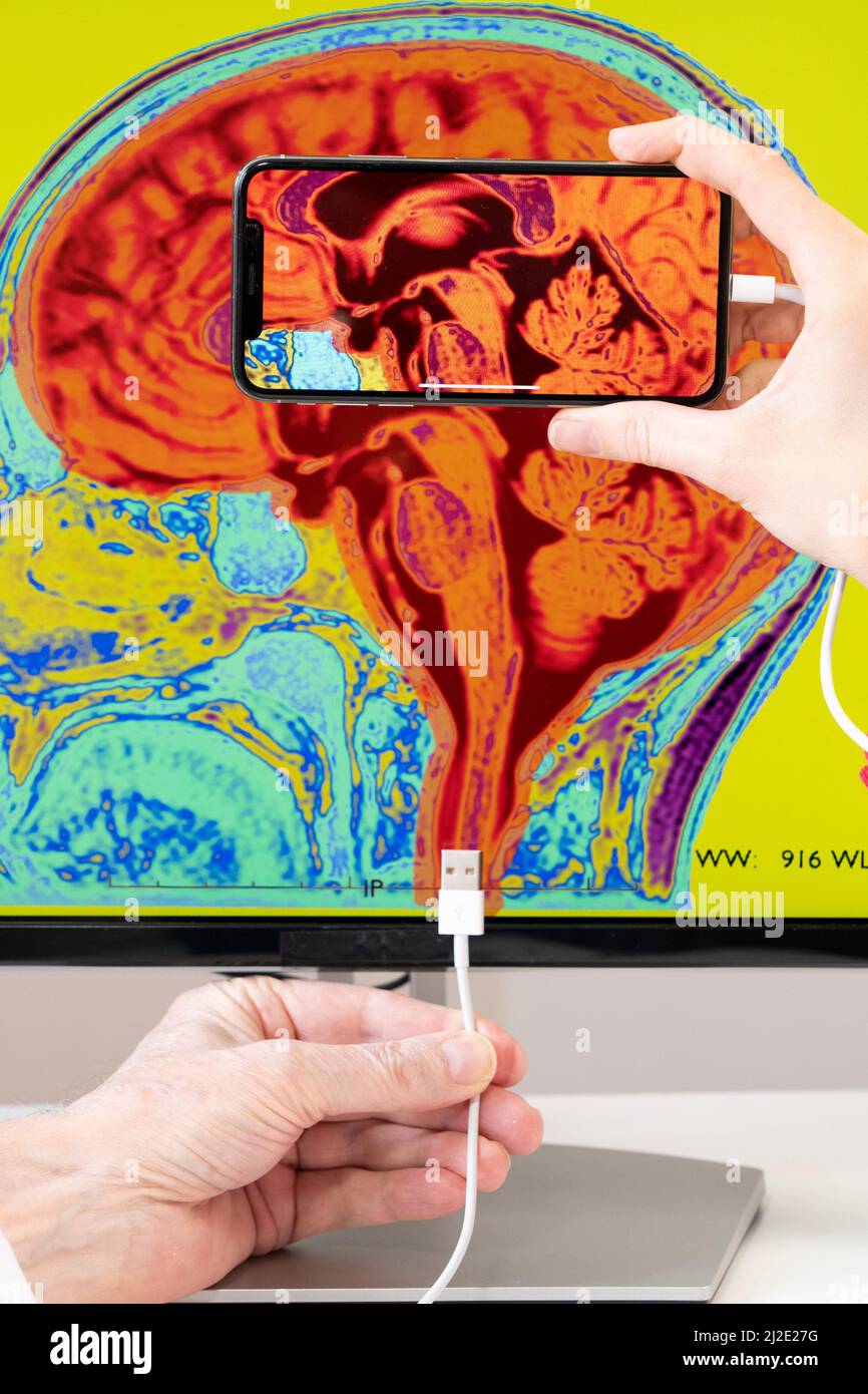 Smartphone connected to the brain Stock Photo - Alamy