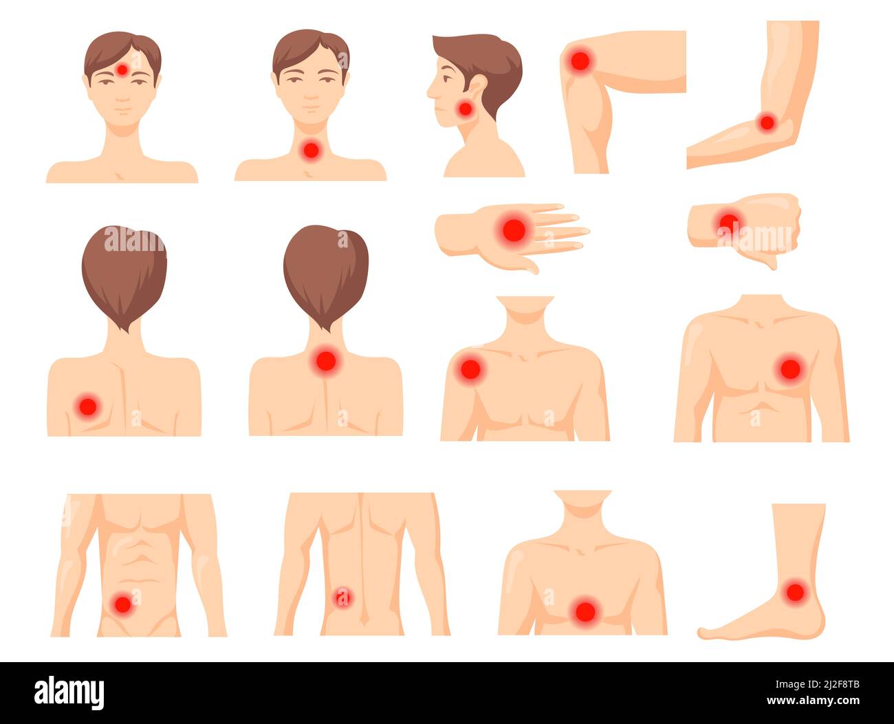 Focus of pain set. Parts of human body with red spot, ache in muscles or  joints. Vector illustration for inflammation, chronic disease, painkiller,  he Stock Vector Image & Art - Alamy