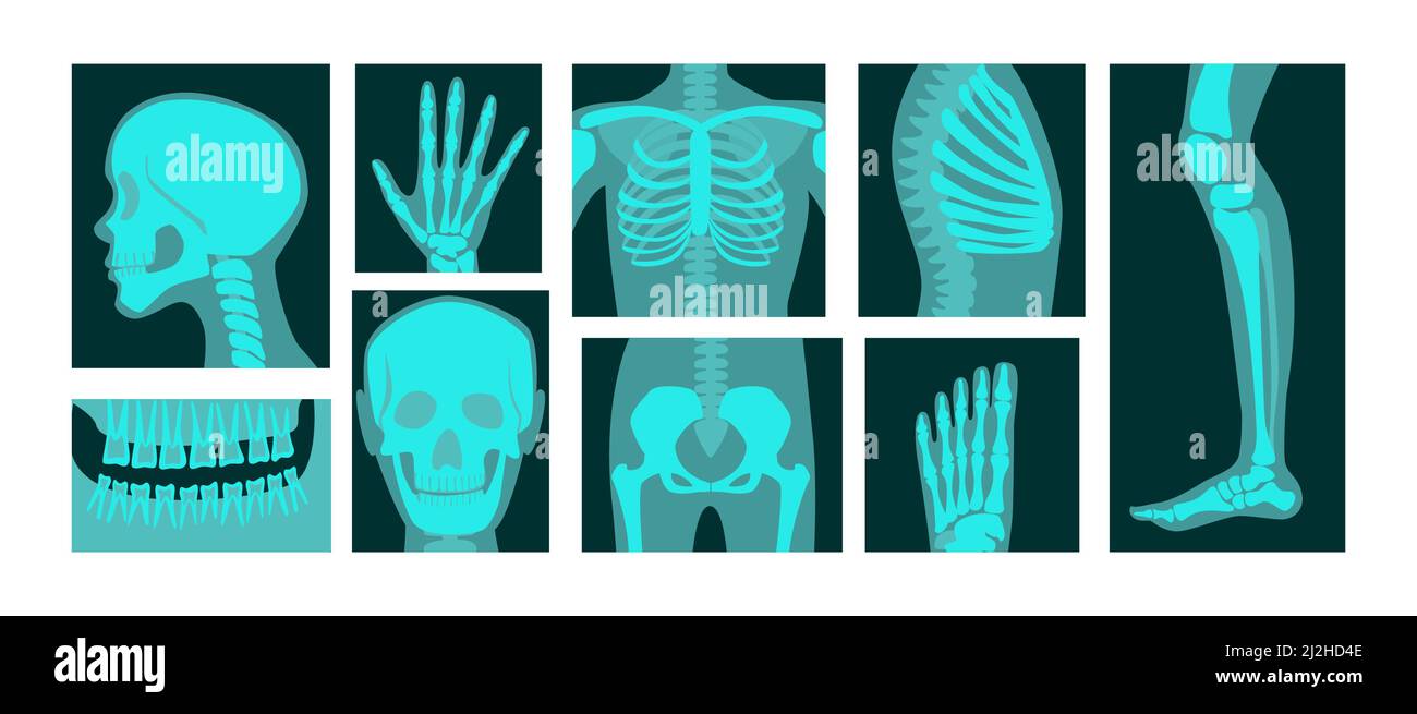 X-ray of human body parts vector illustrations set. Bones of skeleton, roentgen of head, chest, hand, leg, knee, foot radiographs isolated on white ba Stock Vector