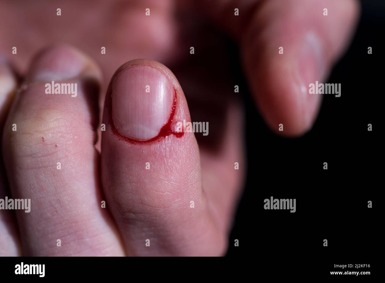 Knife cut finger bleeding macro bloody finger slice. Stock Photo