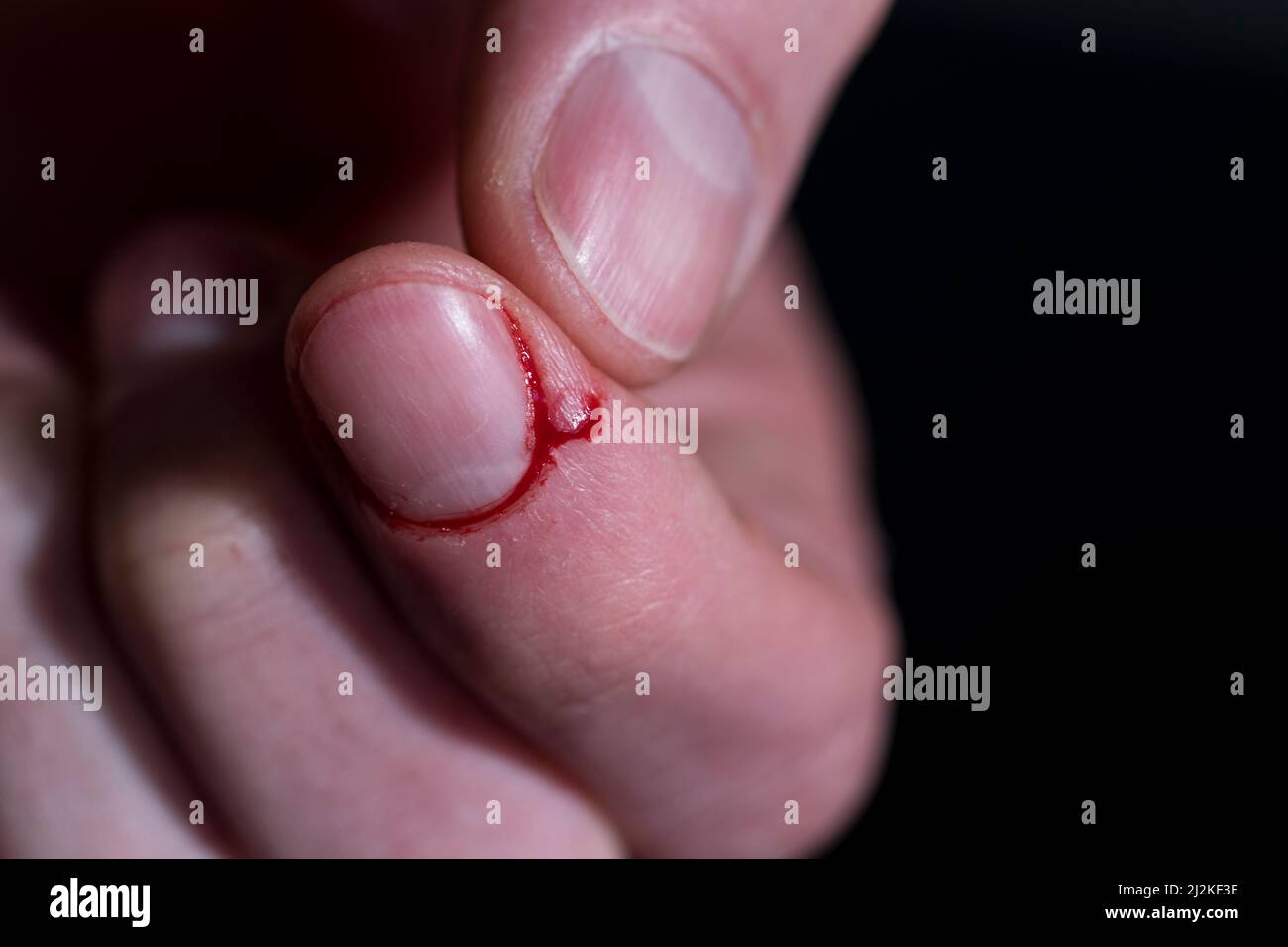 Sliced finger bleeding close up finger injury. Open wound from knife cut on finger tip. Stock Photo