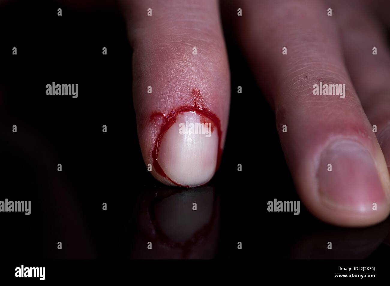 Injury bloody finger close up cut finger tip from knife slice. Stock Photo