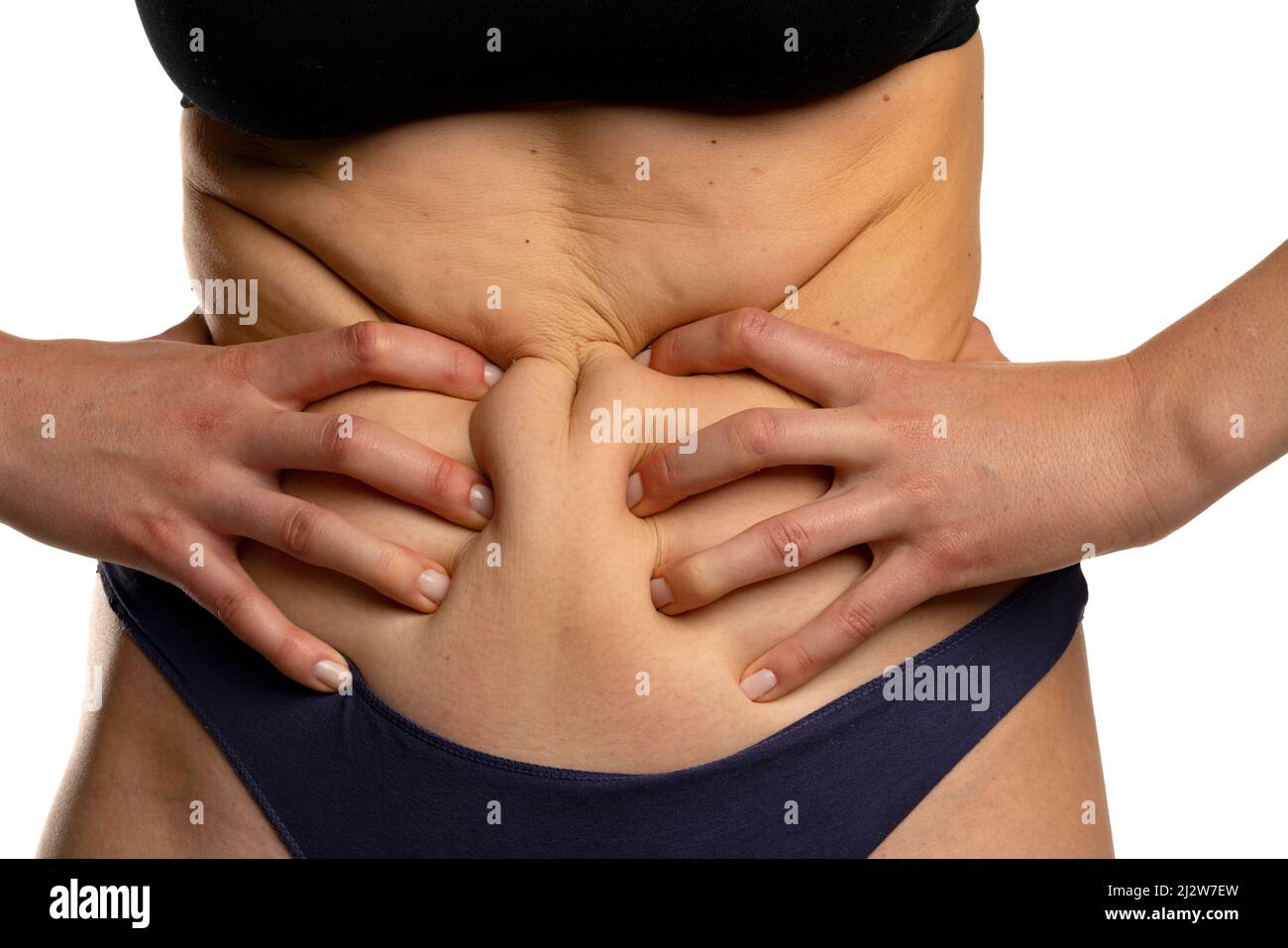 Woman grabbing skin on her flanks with the black color crosses marking,  Lose weight and liposuction cellulite removal concept, Isolated on white  backg Stock Photo - Alamy