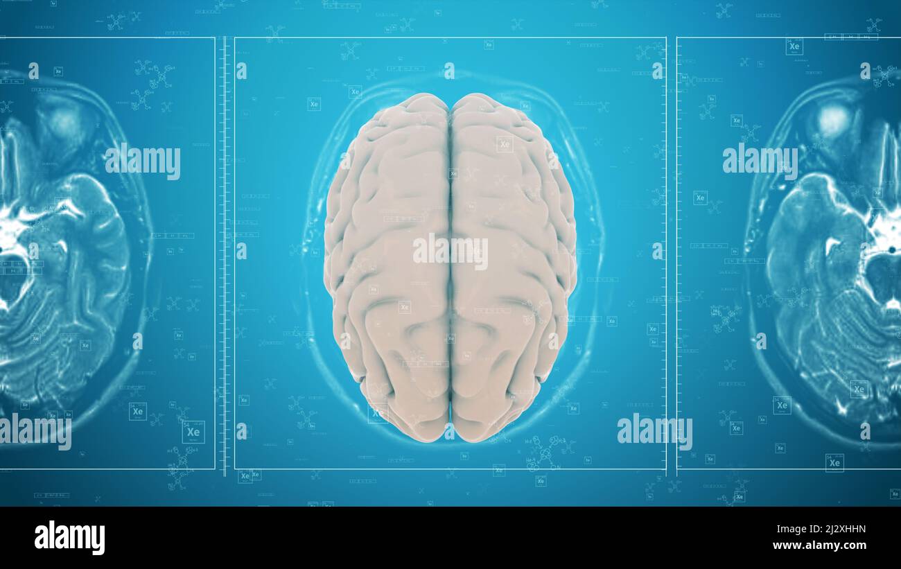 Mri brain activity hires stock photography and images Alamy