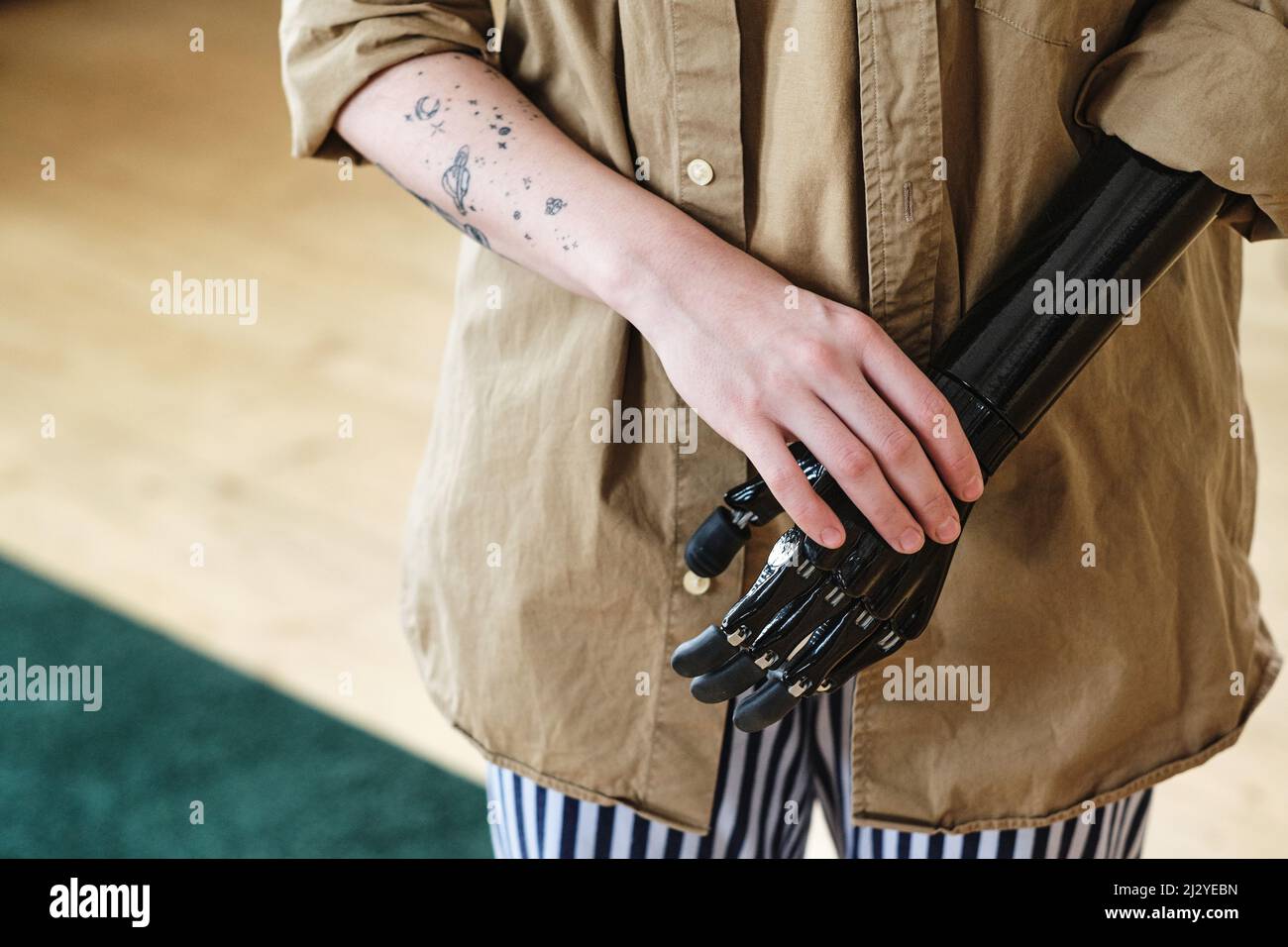 Close-up of young woman in shirt having prosthetic arm instead of amputee arm Stock Photo