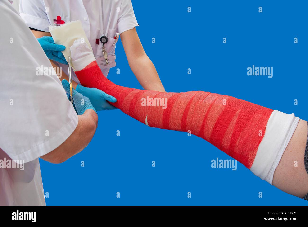 Netherlands, a splint is used to heal a broken leg. A splint is defined