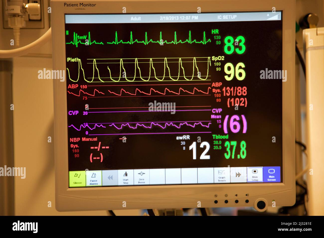 Netherlands, a patient monitor in hospital to show ao heart rate, blood and oxygen. Stock Photo