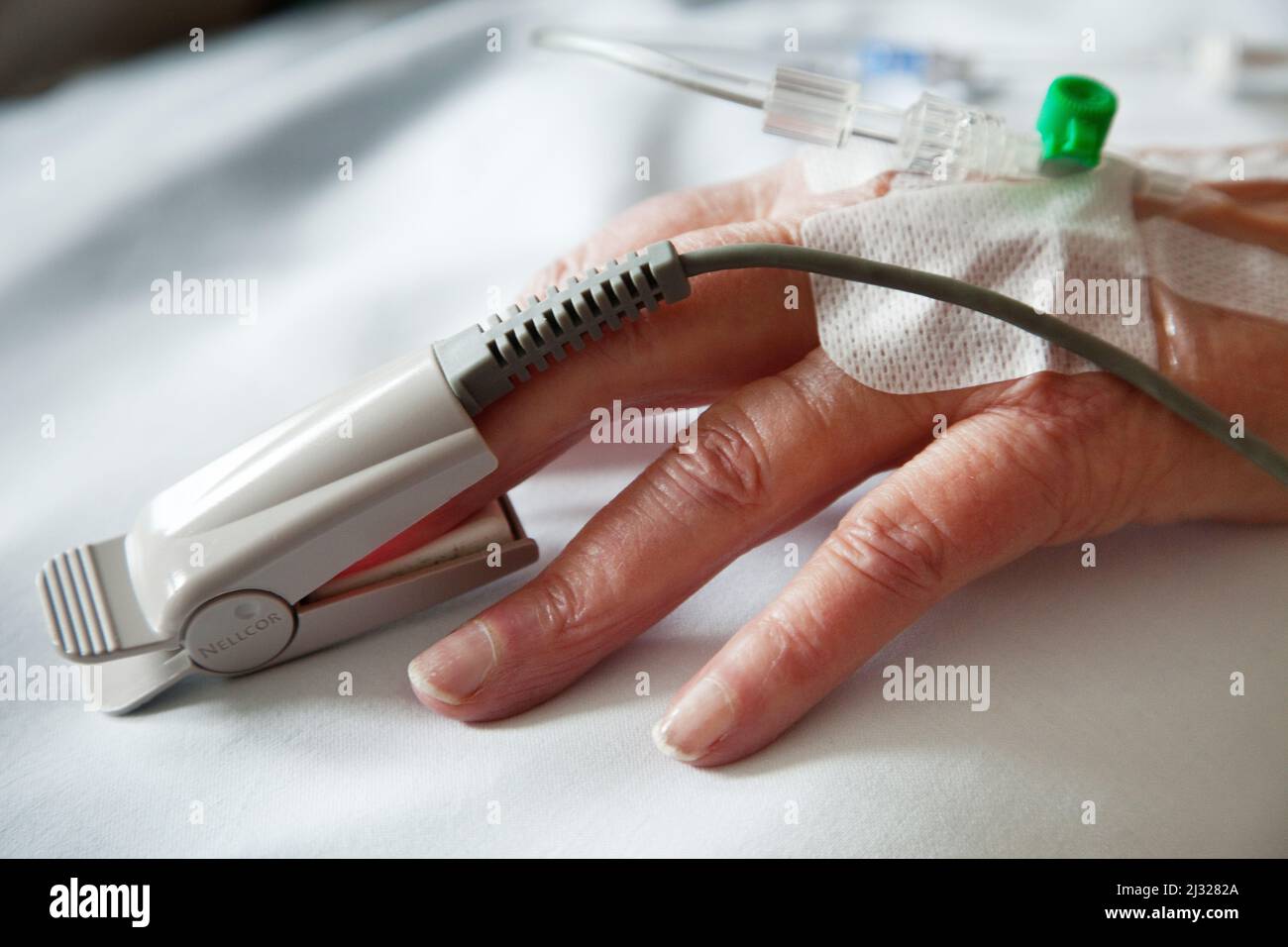 Netherlands, a pulse oximeter used to measure the oxygen in the blood