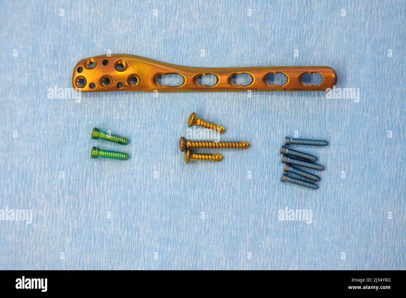 a titanium surgical plate and titanium screws for the treatment of a