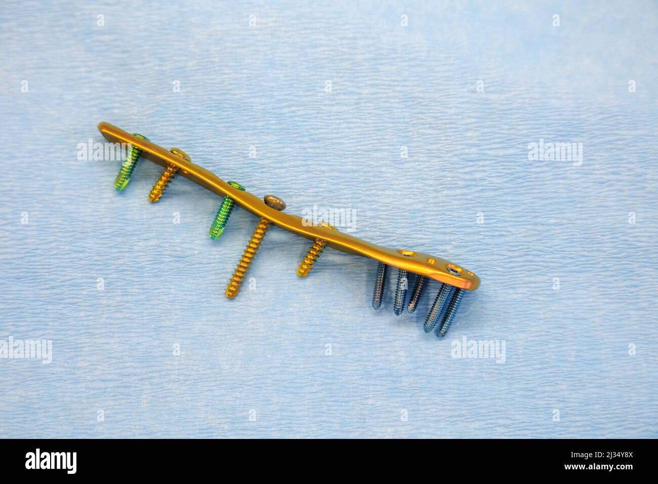 a titanium surgical plate and titanium screws for the treatment of a