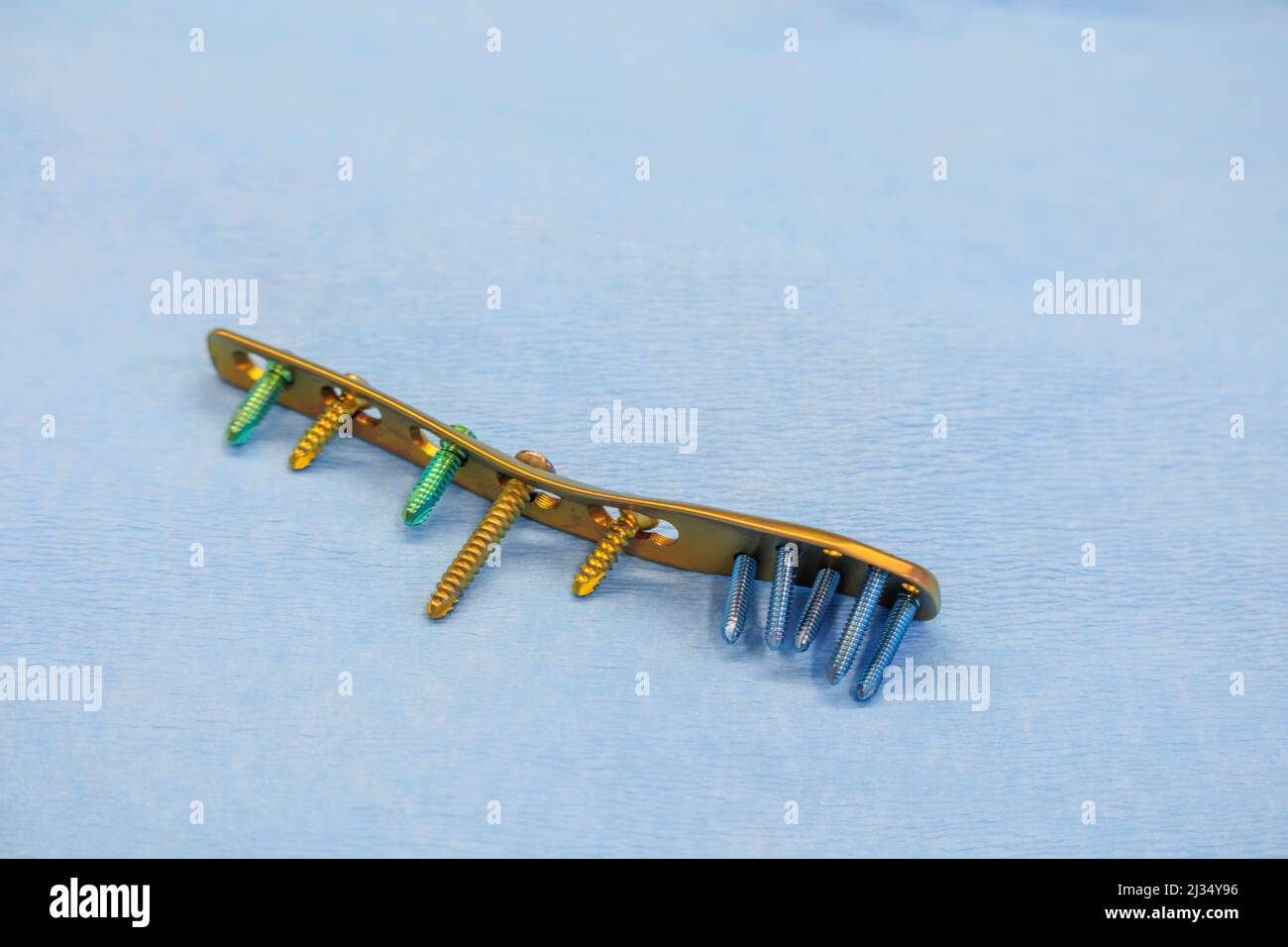 a titanium surgical plate and titanium screws for the treatment of a