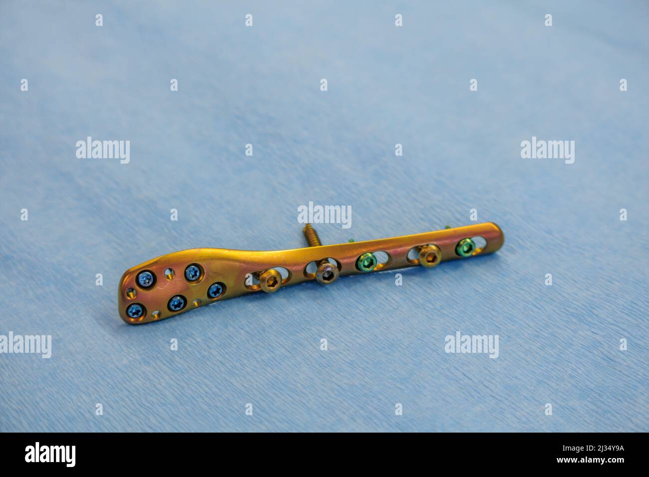 a titanium surgical plate and titanium screws for the treatment of a