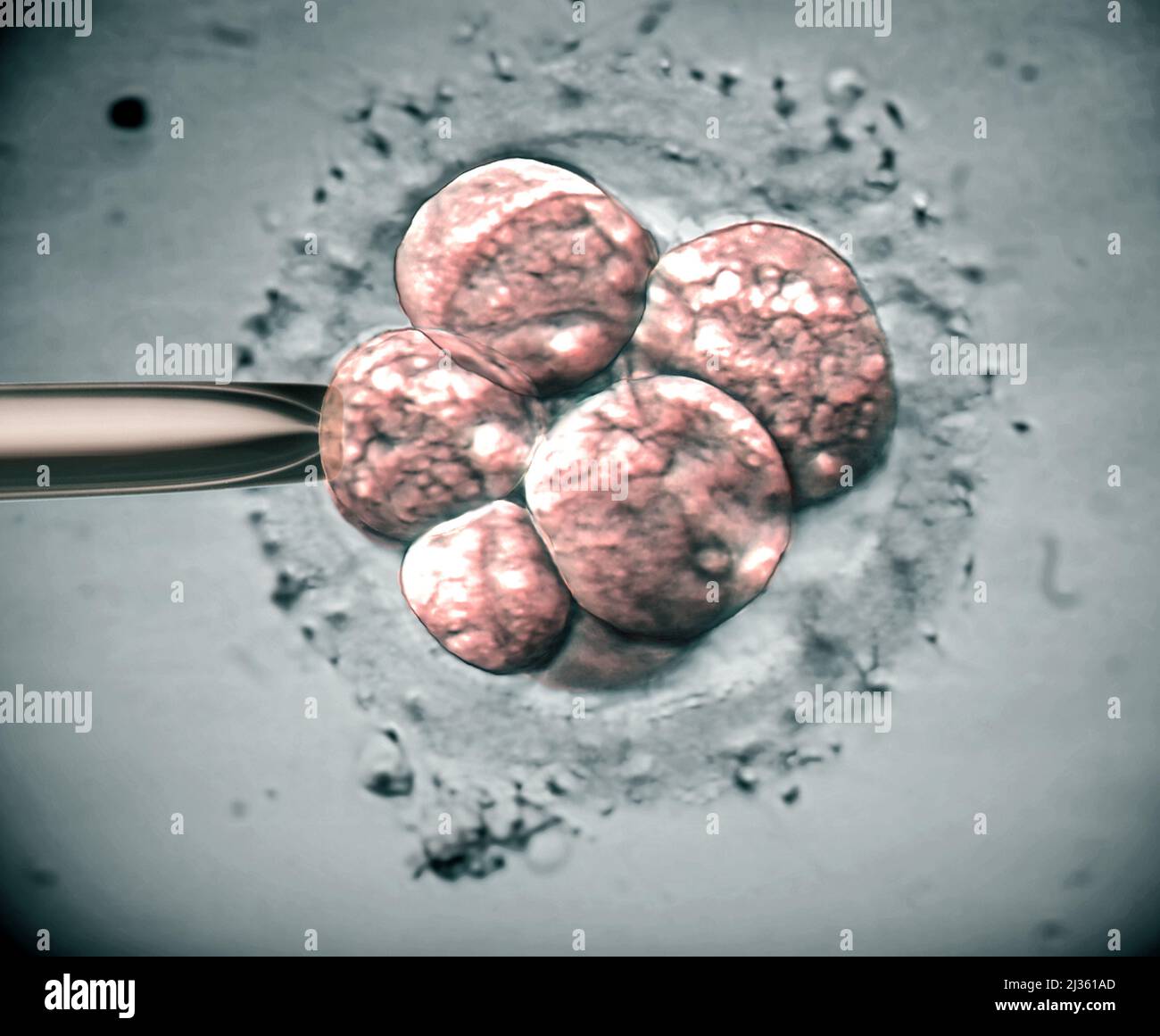 Embryon Microscope IVF embryo, light micrograph Stock Photo - Alamy