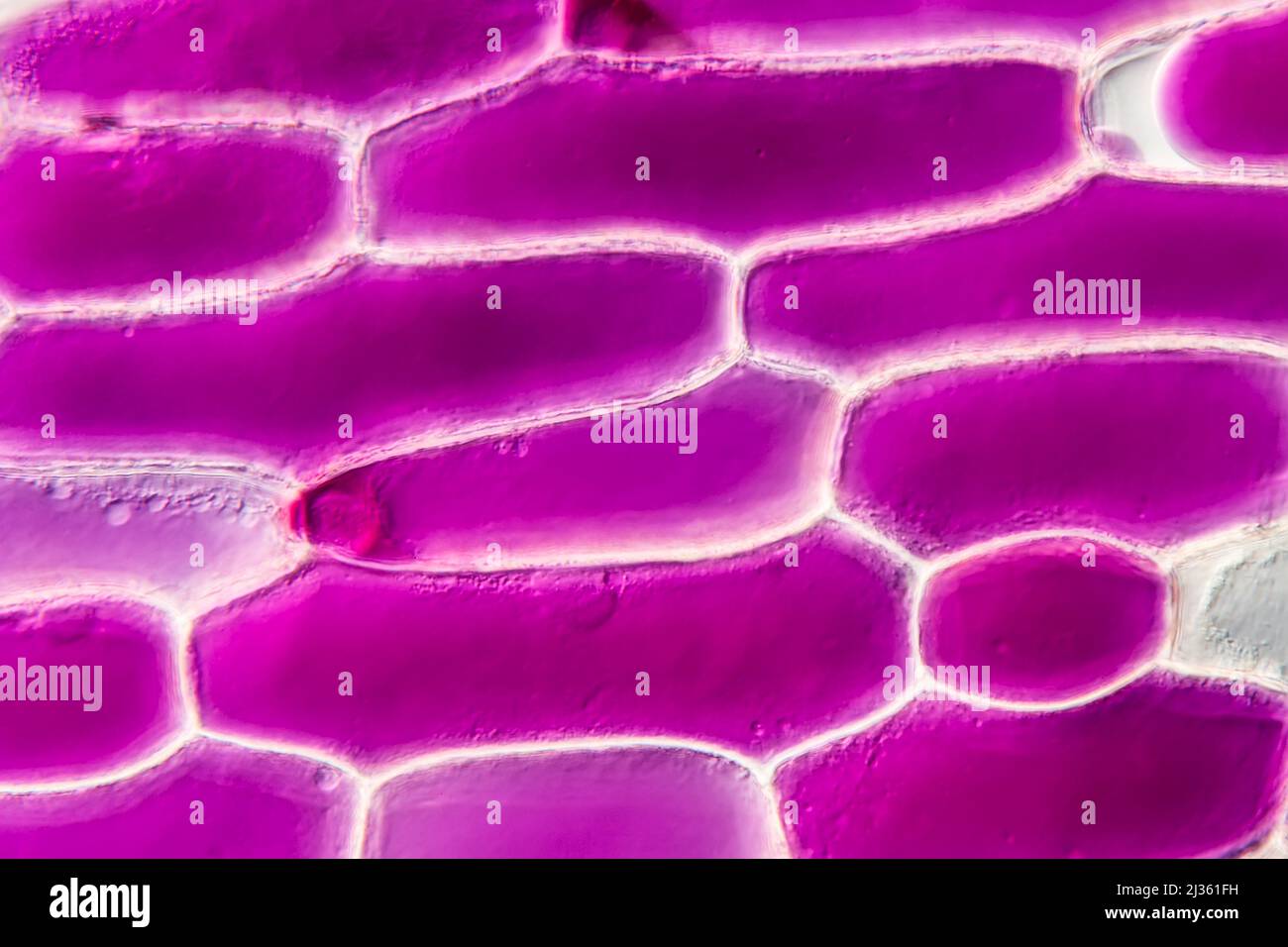 Onion epidermis plasmolysis, light micrograph Stock Photo Alamy