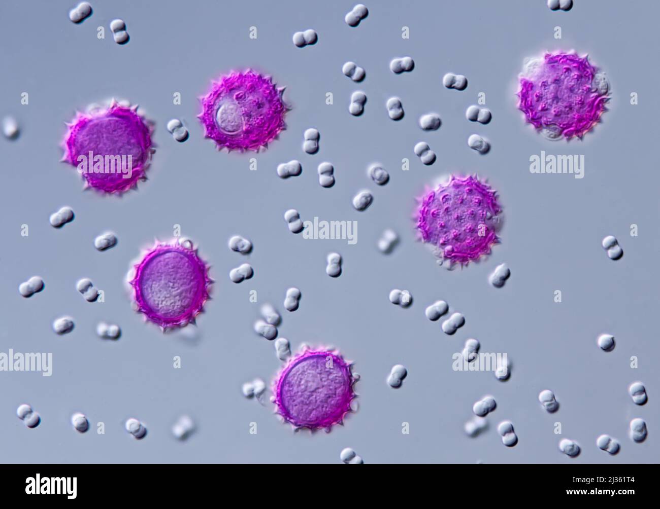 Pollen grains size comparison preparation, light micrograph Stock Photo ...